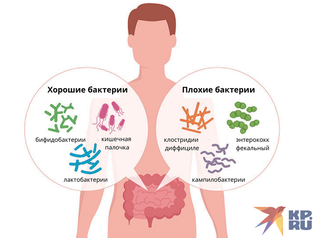 Дисбактериоз кишечника