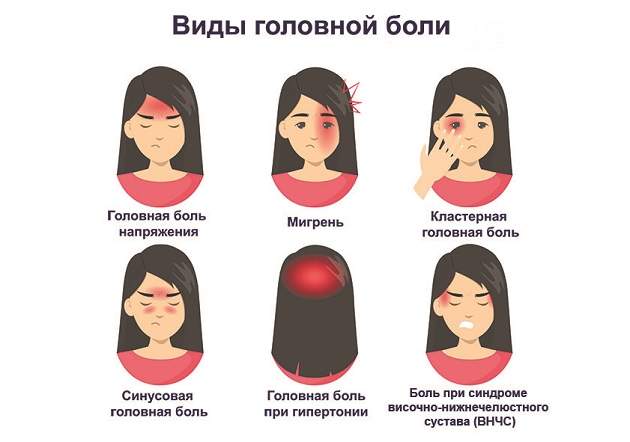 Мигрень и другие виды головной боли