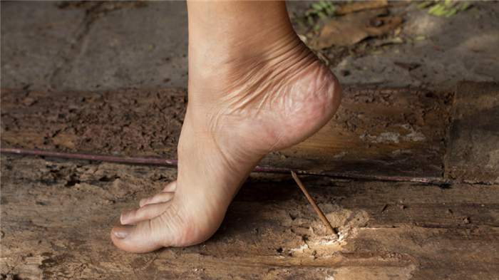 Наступил на ржавый гвоздь