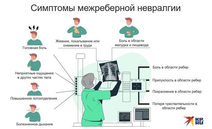 Признаки межреберной невралгии