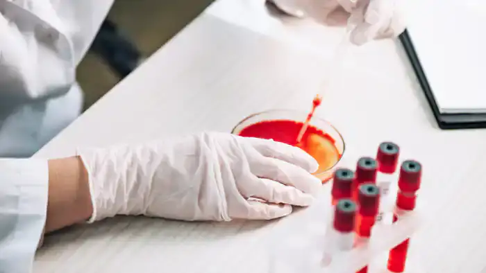 В России выявлен неизвестный вирус с симптомами кашля и высокой температуры