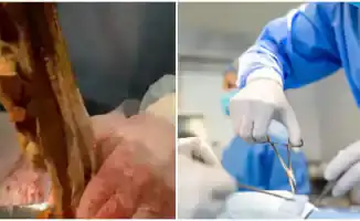 Алматинка 9 месяцев страдала от забытой салфетки: шокирующая история с улицы Тимирязева