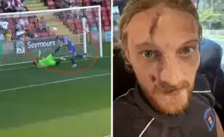 Вратарь расколол голову: шокирующий момент матча Карлайла и Уокинга