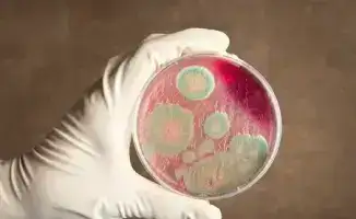 Байсерке: угрозы сибирской язвы нет