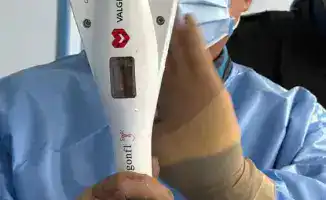 Успешная операция по восстановлению митрального клапана у пациента высокого хирургического риска в НИИКВБ