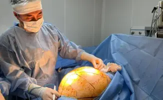 В Алматы хирургия победила невидимого врага: 25-килограммовая опухоль удалена