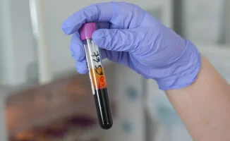 Жительница Алматы не смогла стать донором крови из-за использования популярного препарата для похудения, что вызвало у нее недоумение и вопросы о правилах донорства.